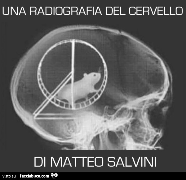 Radiografia del cervello